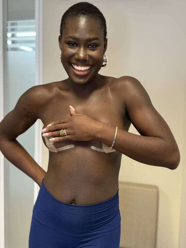 Wo entstehen Narben?